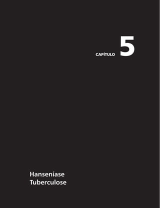 Guia de Vigilância em Saúde
304
Definição de caso
Primeiro critério
r $SJBOÉBDVKBNÈFBQSFTFOUF
EVSBOUFPQSÊOBUBMPVOPNPNFOUPEPQBSUP
UFTUFTQBSBTÎGJMJTOÈP
treponêmico reagente com qualquer titulação e treponêmico reagente, e que não tenha sido tratada
ou tenha recebido tratamento inadequado.
r $SJBOÉBDVKBNÈFOÈPGPJEJBHOPTUJDBEBDPNTÎGJMJTEVSBOUFBHFTUBÉÈPF
OBJNQPTTJCJMJEBEFEFB
maternidade realizar o teste treponêmico, apresente teste não treponêmico reagente com qualquer
titulação no momento do parto.
r $SJBOÉBDVKBNÈFOÈPGPJEJBHOPTUJDBEBDPNTÎGJMJTEVSBOUFBHFTUBÉÈPF
OBJNQPTTJCJMJEBEFEFB
maternidade realizar o teste não treponêmico, apresente teste treponêmico reagente no momento
do parto.
r $SJBOÉBDVKBNÈFBQSFTFOUFUFTUFUSFQPOËNJDPSFBHFOUFFUFTUFOÈPUSFQPOËNJDPOÈPSFBHFOUFOP
momento do parto, sem registro de tratamento prévio.
Segundo critério
Todo indivíduo com menos de 13 anos de idade com pelo menos uma das seguintes evidências sorológicas:
r UJUVMBÉ×FTBTDFOEFOUFT	UFTUFTOÈPUSFQPOËNJDPT

r UFTUFTOÈPUSFQPOËNJDPTSFBHFOUFTBQÓTNFTFTEFJEBEF	FYDFUPFNTJUVBÉÈPEFTFHVJNFOUPUFSBQËVUJDP

r UFTUFTUSFQPOËNJDPTSFBHFOUFTBQÓTNFTFTEFJEBEF
r UÎUVMPTFNUFTUFOÈPUSFQPOËNJDPNBJPSFTEPRVFPTEBNÈF
FNMBDUFOUFT
r UFTUFOÈPUSFQPOËNJDPSFBHFOUFDPNQFMPNFOPTVNBEBTBMUFSBÉ×FTDMÎOJDB
MJRVÓSJDBPVSBEJPMÓ-
gica de sífilis congênita.
Terceiro critério
Aborto ou natimorto cuja mãe apresente testes para sífilis não treponêmico reagente com qualquer
titulação ou teste treponêmico reagente, realizados durante o pré-natal, no momento do parto ou cureta-
gem, que não tenha sido tratada ou tenha recebido tratamento inadequado.
Quarto critério
Toda situação de evidência de infecção pelo T. pallidum em placenta ou cordão umbilical e/ou amos-
tra da lesão, biópsia ou necrópsia de criança, aborto ou natimorto. Em caso de apenas evidência sorológi-
ca, deve ser afastada a possibilidade de sífilis adquirida.
Tratamento inadequado
Entende-se por tratamento inadequado:
r USBUBNFOUPSFBMJ[BEPDPNRVBMRVFSNFEJDBNFOUPRVFOÈPTFKBBQFOJDJMJOBPV
r USBUBNFOUPJODPNQMFUP
NFTNPUFOEPTJEPGFJUPDPNQFOJDJMJOBPV
r USBUBNFOUPJOBEFRVBEPQBSBBGBTFDMÎOJDBEBEPFOÉBPV
r JOTUJUVJÉÈPEFUSBUBNFOUPEFOUSPEPQSB[PFNBUÊEJBTBOUFTEPQBSUPPV
r QBSDFJSP	T
TFYVBM	JT
DPNTÎêMJTOÈPUSBUBEPPVUSBUBEPJOBEFRVBEBNFOUF
 