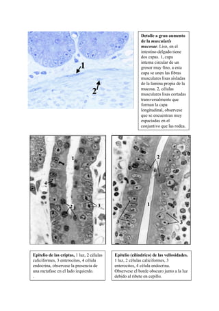 Detalle a gran aumento
                                                           de la muscularis
                                                           mucosae. Liso, en el
                                                           intestino delgado tiene
                                                           dos capas. 1, capa
                                                           interna circular de un
                            1                              grosor muy fino, a esta
                                                           capa se unen las fibras
                                                           musculares lisas aisladas
                                                           de la lámina propia de la
                                                           mucosa. 2, células
                                   2                       musculares lisas cortadas
                                                           transversalmente que
                                                           forman la capa
                                                           longitudinal, observese
                                                           que se encuentran muy
                                                           espaciadas en el
                                                           conjuntivo que las rodea.




Epitelio de las criptas, 1 luz, 2 células   Epitelio (cilíndrico) de las vellosidades.
caliciformes, 3 enterocitos, 4 célula       1 luz, 2 células caliciformes, 3
endocrina, observese la presencia de        enterocitos, 4 célula endocrina.
una metafase en el lado izquierdo.          Observese el borde obscuro junto a la luz
.                                           debido al ribete en cepillo.
 