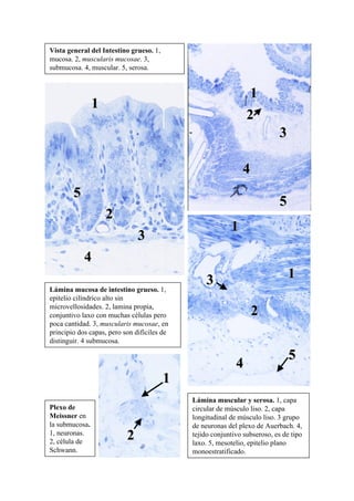 Vista general del Intestino grueso. 1,
mucosa. 2, muscularis mucosae. 3,
submucosa. 4, muscular. 5, serosa.


                                                                 1
                1
                                                                2
                                                                            3

                                                              4
        5
                                                                            5
                    2
                                                          1
                               3
            4
                                                 3                              1
Lámina mucosa de intestino grueso. 1,
epitelio cilíndrico alto sin
microvellosidades. 2, lamina propia,
conjuntivo laxo con muchas células pero                           2
poca cantidad. 3, muscularis mucosae, en
principio dos capas, pero son difíciles de
distinguir. 4 submucosa.

                                                                                5
                                                            4
                                         1
                                             Lámina muscular y serosa. 1, capa
Plexo de                                     circular de músculo liso. 2, capa
Meissner en                                  longitudinal de músculo liso. 3 grupo
la submucosa.                                de neuronas del plexo de Auerbach. 4,
1, neuronas.
2, célula de
                           2                 tejido conjuntivo subseroso, es de tipo
                                             laxo. 5, mesotelio, epitelio plano
Schwann.                                     monoestratificado.
 