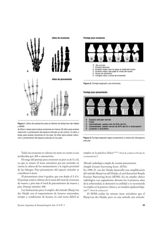 critura, puede emplearse un entrevistador. Los servicios de 
licencias y su costo pueden encontrarse en las siguientes 
páginas web: 
http://www.sf-36.com 
http://www.qualitymetric.com 
Rheumatoid Arthritis Quality of Life (RAQoL) 
El RAQol consta de 30 preguntas sencillas por sí o por no, 
es fácil y rápido, se completa sólo en minutos82. El puntaje 
total es la suma del número de ítems afirmativos. Este cues-tionario 
demostró ser sensible al cambio a los 6 meses83. 
Nivel de evidencia III 
Si bien estos cuestionarios son muy útiles en ensayos 
clínicos para grupos de pacientes, en la práctica diaria no 
son útiles debido al tiempo que insumen para realizarlos. 
Nivel de evidencia V/Grado de recomendación E 
Laboratorio 
El laboratorio basal de un paciente con diagnóstico de AR 
debe contemplar una rutina que incluya84: 
r )FNPHSBNBDPNQMFUP	SFDVFOUPEFHMÓCVMPTSPKPT
 
Dimensión Significado 
hematocrito, hemoglobina, recuento y fórmula leuco-citaria 
y recuento de plaquetas). 
r 3FBDUBOUFTEFGBTFBHVEB34Z1$3 
r 'VODJÓOIFQÃUJDBO[JNBTIFQÃUJDBT	5(0
5(1Z 
Fosfatasa Alcalina). 
r 'VODJÓO SFOBM VSFNJB
 DSFBUJOJOB
 PSJOB DPNQMFUB 
Estas determinaciones deben evaluarse con una perio-dicidad 
de 3 meses. Nivel de evidencia V 
Eritrosedimentación (ERS): El método recomendado 
para su determinación por el Consejo Internacional de 
Normatización en Hematología es el de Westergren con 
lectura a los 60 minutos. Valores elevados de la misma se 
asocian con enfermedad severa y se correlaciona con otros 
reactantes de fase aguda (r: 0.55)85. Ha demostrado ser sen-sible 
al cambio86 y niveles basales altos demostraron ser 
predictores de progresión radiológica a los 3 años, OR: 
3.44 (IC95% 1.39-8.5)87. Nivel de evidencia I,II 
Hay que considerar que la ERS es influida por otros fac-tores 
como edad, sexo y presencia de anemia, etc. Ante un 
estímulo inflamatorio aumenta dentro de la 24-48 horas y 
Función física Grado en el que la falta de salud limita las actividades físicas de la vida diaria, como el cuidado personal, 
DBNJOBS
TVCJSFTDBMFSBT
MFWBOUBSPUSBOTQPSUBSDBSHBT
ZSFBMJ[BSFTGVFS[PTNPEFSBEPTFJOUFOTPT 
Rol físico Grado en el que la falta de salud interfiere en el trabajo y otras actividades diarias, produciendo como 
consecuencia un rendimiento menor del deseado, o limitando el tipo de actividades que se pueden realizar o 
MBEJmDVMUBEFOSFBMJ[BSMBTNJTNBT 
Dolor corporal .FEJEBEFMBJOUFOTJEBEEFMEPMPSQBEFDJEPZTVFGFDUPFOFMUSBCBKPIBCJUVBMZFOMBTBDUJWJEBEFTEFMIPHBS 
Salud general 7BMPSBDJØOQFSTPOBMEFMFTUBEPEFTBMVE
RVFJODMVZFMBTJUVBDJØOBDUVBMZMBTQFSTQFDUJWBTGVUVSBTZMB 
SFTJTUFODJBBFOGFSNBS 
Vitalidad 4FOUJNJFOUPEFFOFSHÓBZWJUBMJEBE
GSFOUFBMDBOTBODJPZEFTÈOJNP 
Función social Grado en el que los problemas físicos o emocionales derivados de la falta de salud interfieren en la vida 
TPDJBMIBCJUVBM 
Rol emocional Grado en el que los problemas emocionales afectan al trabajo y otras actividades diarias, considerando la 
SFEVDDJØOEFMUJFNQPEFEJDBEP
EJTNJOVDJØOEFMSFOEJNJFOUPZEFMFTNFSPFOFMUSBCBKP 
Salud mental 7BMPSBDJØOEFMBTBMVENFOUBMHFOFSBM
DPOTJEFSBOEPMBEFQSFTJØO
MBBOTJFEBE
FMBVUPDPOUSPMZFMCJFOFTUBS 
HFOFSBM 
SF-36 
3FWJTUBSHFOUJOBEF3FVNBUPMPHÎBrÒPr/ 21 
 