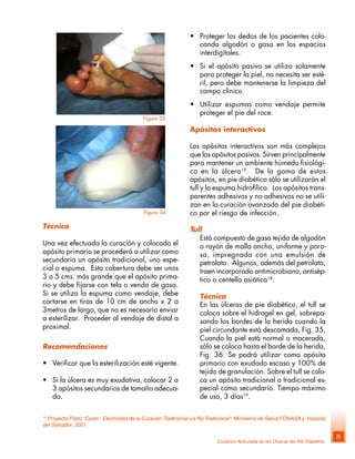 Curación Avanzada de las Úlceras del Pié Diabético
25
Figura 33
Figura 34
Técnica
Una vez efectuada la curación y colocado el
apósito primario se procederá a utilizar como
secundario un apósito tradicional, uno espe-
cial o espuma. Esta cobertura debe ser unos
3 a 5 cms. más grande que el apósito prima-
rio y debe fijarse con tela o venda de gasa.
Si se utiliza la espuma como vendaje, debe
cortarse en tiras de 10 cm de ancho x 2 a
3metros de largo, que no es necesario enviar
a esterilizar. Proceder al vendaje de distal a
proximal.
Recomendaciones
• Verificar que la esterilización esté vigente.
• Si la úlcera es muy exudativa, colocar 2 a
3 apósitos secundarios de tamaño adecua-
do.
19
Proyecto Piloto “Costo - Efectividad de la Curación Tradicional v/s No Tradicional”, Ministerio de Salud,FONASA y Hospital
del Salvador, 2001.
• Proteger los dedos de los pacientes colo-
cando algodón o gasa en los espacios
interdigitales.
• Si el apósito pasivo se utiliza solamente
para proteger la piel, no necesita ser esté-
ril, pero debe mantenerse la limpieza del
campo clínico.
• Utilizar espumas como vendaje permite
proteger el pie del roce.
Apósitos interactivos
Los apósitos interactivos son más complejos
que los apósitos pasivos. Sirven principalmente
para mantener un ambiente húmedo fisiológi-
co en la úlcera18
. De la gama de estos
apósitos, en pie diabético sólo se utilizarán el
tull y la espuma hidrofílica. Los apósitos trans-
parentes adhesivos y no adhesivos no se utili-
zan en la curación avanzada del pie diabéti-
co por el riesgo de infección.
Tull
Está compuesto de gasa tejida de algodón
o rayón de malla ancha, uniforme y poro-
sa, impregnada con una emulsión de
petrolato. Algunos, además del petrolato,
traen incorporado antimicrobiano, antisép-
tico o centella asiática18
.
Técnica
En las úlceras de pie diabético, el tull se
coloca sobre el hidrogel en gel, sobrepa-
sando los bordes de la herida cuando la
piel circundante está descamada, Fig. 35.
Cuando la piel está normal o macerada,
sólo se coloca hasta el borde de la herida,
Fig. 36. Se podrá utilizar como apósito
primario con exudado escaso y 100% de
tejido de granulación. Sobre el tull se colo-
ca un apósito tradicional o tradicional es-
pecial como secundario. Tiempo máximo
de uso, 3 días19
.
 
