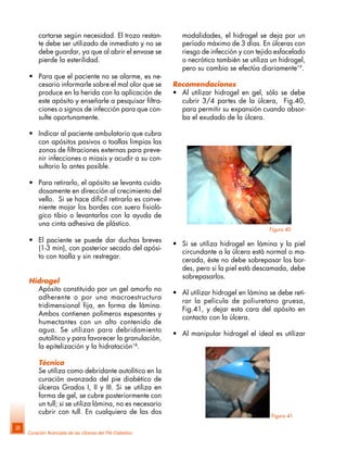 Curación Avanzada de las Úlceras del Pié Diabético
28
cortarse según necesidad. El trozo restan-
te debe ser utilizado de inmediato y no se
debe guardar, ya que al abrir el envase se
pierde la esterilidad.
• Para que el paciente no se alarme, es ne-
cesario informarle sobre el mal olor que se
produce en la herida con la aplicación de
este apósito y enseñarle a pesquisar filtra-
ciones o signos de infección para que con-
sulte oportunamente.
• Indicar al paciente ambulatorio que cubra
con apósitos pasivos o toallas limpias las
zonas de filtraciones externas para preve-
nir infecciones o miasis y acudir a su con-
sultorio lo antes posible.
• Para retirarlo, el apósito se levanta cuida-
dosamente en dirección al crecimiento del
vello. Si se hace difícil retirarlo es conve-
niente mojar los bordes con suero fisioló-
gico tibio o levantarlos con la ayuda de
una cinta adhesiva de plástico.
• El paciente se puede dar duchas breves
(1-3 min), con posterior secado del apósi-
to con toalla y sin restregar.
Hidrogel
Apósito constituido por un gel amorfo no
adherente o por una macroestructura
tridimensional fija, en forma de lámina.
Ambos contienen polímeros espesantes y
humectantes con un alto contenido de
agua. Se utilizan para debridamiento
autolítico y para favorecer la granulación,
la epitelización y la hidratación18
.
Técnica
Se utiliza como debridante autolítico en la
curación avanzada del pie diabético de
úlceras Grados I, II y III. Si se utiliza en
forma de gel, se cubre posteriormente con
un tull; si se utiliza lámina, no es necesario
cubrir con tull. En cualquiera de las dos
modalidades, el hidrogel se deja por un
período máximo de 3 días. En úlceras con
riesgo de infección y con tejido esfacelado
o necrótico también se utiliza un hidrogel,
pero su cambio se efectúa diariamente19
.
Recomendaciones
• Al utilizar hidrogel en gel, sólo se debe
cubrir 3/4 partes de la úlcera, Fig.40,
para permitir su expansión cuando absor-
ba el exudado de la úlcera.
Figura 40
Figura 41
• Si se utiliza hidrogel en lámina y la piel
circundante a la úlcera está normal o ma-
cerada, éste no debe sobrepasar los bor-
des, pero si la piel está descamada, debe
sobrepasarlos.
• Al utilizar hidrogel en lámina se debe reti-
rar la película de poliuretano gruesa,
Fig.41, y dejar esta cara del apósito en
contacto con la úlcera.
• Al manipular hidrogel el ideal es utilizar
 