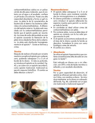 Curación Avanzada de las Úlceras del Pié Diabético
31
carboximetilcelulosa sódica es un polisa-
cárido de alto peso molecular, que al con-
tacto con el agua o el exudado, confiere
un pH ácido a la solución. Posee una alta
capacidad absorbente y forma un gel vis-
coso. La plata le da la característica de
bactericida al destruir las bacterias adhe-
ridas a la carboximetilcelulosa. A diferen-
cia del apósito anterior, la plata está mez-
clada con la carboximetilcelulosa permi-
tiendo que el apósito pueda ser recorta-
do. Los iones de sodio del exudado se unen
al apósito causando la liberación de la
plata iónica desde las fibras de la cobertu-
ra. La plata está distribuida homogénea-
mente en el apósito18
. Existe en láminas y
cintas.
Técnica
Después de realizar el lavado por arrastre
mecánico se aplica el apósito por cualquier
cara, pudiendo sobrepasar 2 a 3 cm el
borde de la úlcera. Si ésta es profunda,
se introduce el apósito en la cavidad, Fig.
45, y se cubre con un apósito secundario,
como apósito tradicional, tradicional es-
pecial o espuma hidrofílica. El cambio se
debe efectuar a diario20
.
Recomendaciones
• El apósito debe sobrepasar 2 a 3 cm el
borde la úlcera, para mantener controla-
dos los microorganismos a su alrededor.
• En úlceras profundas o cavitadas es nece-
sario introducir el apósito rellenando los
espacios muertos para permitir su acción
en toda la herida.
• En cavidades es ideal utilizar cintas de
carboximetilcelulosa con plata.
• Por contener plata, nunca se debe dejar el
apósito en contacto con la luz solar por-
que mancha la piel.
• Si el apósito se encontrara endurecido en
el área de la úlcera cuando la herida se
descubra, humedecer la zona con suero
fisiológico antes de retirarlo.
• El cambio es a diario.
• Absorbente
Se utiliza el apósito hiperosmótico que con-
tiene concentraciones altas de sodio en una
gasa no tejida19
.
Está indicado en úlceras con o sin infec-
ción, con 50% o más de tejido necrótico o
esfacelo y con exudado abundante.
Técnica
Por su gran capacidad de absorción, el
apósito se utiliza por períodos cortos, máxi-
mo 3 días, con cambios a diario. Se intro-
duce totalmente en la úlcera sin sobresalir
del borde, Fig. 46, cubriendo con un apó-
sito tradicional o tradicional especial19
.
20
MINSAL, Hospitales y Consultorios SNSS, Regiones VI, VIII y Metropolitana: “Costo–Efectividad Carboximetilcelulosa v/s
Gasa en Pacientes Infectados”: julio-diciembre 2004
Figura 46Figura 45
 