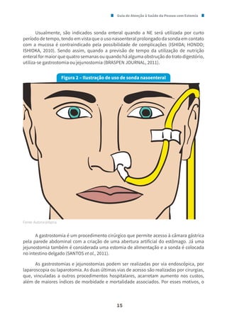 Guia de Atenção à Saúde da Pessoa com Estomia
15
Usualmente, são indicados sonda enteral quando a NE será utilizada por curto
período de tempo, tendo em vista que o uso nasoenteral prolongado da sonda em contato
com a mucosa é contraindicado pela possibilidade de complicações (ISHIDA; HONDO;
ISHIOKA, 2010). Sendo assim, quando a previsão de tempo da utilização de nutrição
enteral for maior que quatro semanas ou quando há alguma obstrução do trato digestório,
utiliza-se gastrostomia ou jejunostomia (BRASPEN JOURNAL, 2011).
Figura 2 – Ilustração de uso de sonda nasoenteral
Fonte: Autoria própria.
A gastrostomia é um procedimento cirúrgico que permite acesso à câmara gástrica
pela parede abdominal com a criação de uma abertura artificial do estômago. Já uma
jejunostomia também é considerada uma estomia de alimentação e a sonda é colocada
no intestino delgado (SANTOS et al., 2011).
As gastrostomias e jejunostomias podem ser realizadas por via endoscópica, por
laparoscopia ou laparotomia. As duas últimas vias de acesso são realizadas por cirurgias,
que, vinculadas a outros procedimentos hospitalares, acarretam aumento nos custos,
além de maiores índices de morbidade e mortalidade associados. Por esses motivos, o
 
