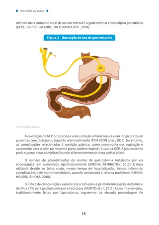 Ministério da Saúde
16
método mais comum e atual de acesso enteral é a gastrostomia endoscópica percutânea
(GEP). (FOREST-LALANDE, 2011; D’AVILA et al., 2008).
Figura 3 – Ilustração de uso de gastrostomia
Fonte: Autoria própria.
A realização da GEP proporciona uma nutrição enteral segura e em longo prazo em
pacientes com disfagia ou ingestão oral insuficiente (TOH YOON et al., 2016). No entanto,
as complicações relacionadas à nutrição gástrica, como pneumonia por aspiração e
vazamento para a pele periestomia grave, podem impedir o uso da GEP. A jejunostomia
pode superar essas complicações com o fornecimento de dieta após o piloro.
O número de procedimentos de sondas de gastrostomia instalados por via
endoscópica tem aumentado significativamente (SIMONS; REMINGTON, 2013). É mais
utilizada devido ao baixo custo, menor tempo de hospitalização, baixos índices de
complicações e de morbimortalidade, quando comparada à técnica tradicional (ISHIDA;
HONDO; ISHIOKA, 2010).
O índice de complicações varia de 6% a 56% para a gastrostomia por laparotomia e
de 2% a 15% para gastrostomia por endoscopia (SANTOS et al., 2011). Essas intervenções,
tradicionalmente feitas por laparotomia, seguem-se de elevada porcentagem de
 
