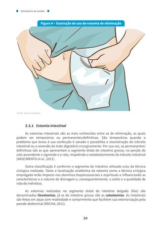 Ministério da Saúde
20
Figura 4 – Ilustração de uso de estomia de eliminação
Fonte: Autoria própria.
3.3.1 Estomia intestinal
As estomias intestinais são as mais conhecidas entre as de eliminação, as quais
podem ser temporárias ou permanentes/definitivas. São temporárias quando o
problema que levou à sua confecção é sanado e possibilita a reconstrução do trânsito
intestinal ou a reversão do trato digestório cirurgicamente. Por sua vez, as permanentes/
definitivas são as que apresentam o segmento distal do intestino grosso, na porção do
colo ascendente e sigmoide e o reto, impedindo o restabelecimento do trânsito intestinal
(NASCIMENTO et al., 2011).
Outra classificação é conforme o segmento do intestino utilizado e/ou da técnica
cirúrgica realizada. Tanto a localização anatômica da estomia como a técnica cirúrgica
empregada terão impacto nos domínios biopsicossociais e espirituais e influenciarão as
características e o volume de drenagem e, consequentemente, o estilo e a qualidade de
vida do indivíduo.
As estomias realizadas no segmento distal do intestino delgado (íleo) são
denominados ileostomias, já as do intestino grosso são as colostomias. As intestinais
são feitas em alças com mobilidade e comprimento que facilitem sua exteriorização pela
parede abdominal (ROCHA, 2011).
 