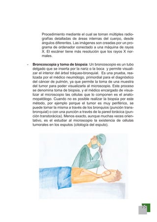 11115555
Procedimiento mediante el cual se toman múltiples radio-
grafías detalladas de áreas internas del cuerpo, desde
ángulos diferentes. Las imágenes son creadas por un pro-
grama de ordenador conectado a una máquina de rayos
X. El escáner tiene más resolución que los rayos X nor-
males.
- Broncoscopia y toma de biopsia: Un broncoscopio es un tubo
delgado que se inserta por la nariz o la boca y permite visuali-
zar el interior del árbol tráqueo-bronquial. Es una prueba, rea-
lizada por el médico neumólogo, primordial para el diagnóstico
del cáncer de pulmón, ya que permite la toma de una muestra
del tumor para poder visualizarla al microscopio. Este proceso
se denomina toma de biopsia, y el médico encargado de visua-
lizar al microscopio las células que lo componen es el anato-
mopatólogo. Cuando no es posible realizar la biopsia por este
método, por ejemplo porque el tumor es muy periférico, se
puede tomar la misma a través de los bronquios (punción trans-
bronquial) o con una punción a través de la pared torácica (pun-
ción transtorácica). Menos exacto, aunque muchas veces orien-
tativo, es el estudiar al microscopio la existencia de células
tumorales en los esputos (citología del esputo).
 