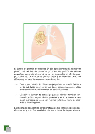 11110000
El cáncer de pulmón se clasifica en dos tipos principales: cáncer de
pulmón de células no pequeñas y cáncer de pulmón de células
pequeñas, dependiendo de cómo se ven las células en el microsco-
pio. Cada tipo de cáncer de pulmón crece y se disemina de forma
diferente y se trata también de forma diferente.
- Cáncer del pulmón de células no pequeñas: es el más frecuen-
te. Se subdivide a su vez, en tres tipos: carcinoma epidermoide,
adenocarcinoma y carcinomas de células grandes.
- Cáncer del pulmón de células pequeñas: llamado también cán-
cer microcítico, cuyas células parecen granos de avena al ver-
las al microscopio; crece con rapidez y de igual forma se dise-
mina a otros órganos.
Es importante conocer las características de los distintos tipos de car-
cinomas ya que en función de las mismas el tratamiento puede variar.
 