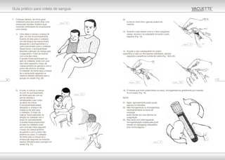 se
a veia for muito fina o garrote poderá ser
mantido.
14. Quando o tubo estiver cheio e o fluxo sangüíneo
cessar, remova-o do adaptador trocando-o pelo
seguinte (Fig. 13).
15. Acoplar o tubo subseqüente em ordem
específica a cada um dos exames solicitados, sempre
seguindo a seqüência correta de coleta (Fig. 14/A e B).
16. À medida que forem preenchidos os tubos, homogeneizá-los gentilmente por inversão
(4 a 6 vezes) (Fig. 15).
NOTA:
01. Agitar vigorosamente pode causar
espuma ou hemólise.
02. Não homogeneizar ou homogeneizar
insuficientemente os tubos de
sorologia
pode resultar em uma demora na
coagulação.
03. Nos tubos com anticoagulante,
homogeneização inadequada pode
resultar em agregação plaquetária
9
e/ou microcoágulos.
• Crianças maiores, de forma geral,
colaboram para que possa fazer uma
venipunção sentada. Existem duas
maneiras confortáveis de se posicionar
uma criança.
1) Uma delas é colocar a criança de
lado, no colo do acompanhante,
ficando de lado para o coletador.
Um dos braços da criança ficará
abraçando o acompanhante e o
outro posicionado para o coletador.
Dessa forma, o acompanhante
desviará a atenção da criança para
si segurando o rosto da mesma
com uma das mãos.
O auxiliar ficará posicionado ao
lado do coletador onde com uma
das mãos segurará o braço da
criança próximo ao garrote e com a
outra mão próximo ao pulso.
O coletador de frente para a criança
faz a venipunção seguindo os
mesmos passos utilizados para a
punção em adulto (Fig. 20).
2) A outra, é colocar a criança
no colo do acompanhante,
de frente para ele com as
pernas abertas e
entrelaçadas a seu corpo,
na altura da cintura.
O acompanhante estará
abraçado a criança e de
costas ou de lado para
o coletador. O braço da
criança ficará estendido na
direção do coletador sob o
braço do acompanhante.
O auxiliar ficará posicionado
ao lado do coletador onde
com uma das mãos segurará
o braço da criança próximo
ao garrote e com a outra mão
próximo ao pulso. O coletador
de frente para a criança faz a
venipunção seguindo os mesmos
passos utilizados para a punção em
adulto (Fig. 21).
1316
Guia prático para coleta de sangue.
Figura - 20
Figura - 15
Figura - 14/A
Figura - 21/A
Figura - 21/B
Figura - 13
Figura - 14/B
 