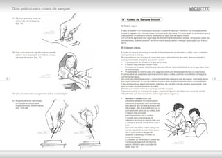 17. Tão logo termine a coleta do
último tubo retirar à agulha
(Fig. 16).
18. Com uma mecha de algodão exercer pressão
sobre o local da punção, sem dobrar o braço,
até parar de sangrar (Fig. 17).
19. Uma vez estancado o sangramento aplicar uma bandagem.
20. A agulha deve ser descartada
em recipiente próprio para
materiais infecto contaminantes.
(Fig. 18/A e B)
IV - Coleta de Sangue Infantil
A) Sala de espera
A sala de espera é um local próprio para que o paciente repouse, mantendo sua fisiologia estável,
enquanto aguarda ser chamado para o procedimento de coleta. Por essa razão, é conveniente que a
criança tenha um ambiente próprio de espera, ou seja, sala de espera infantil.
Um ambiente agradável com algum tipo de entretenimento (televisão, revistas, brinquedos) pode ser
providenciado, quando possível, de forma que a criança desvie a atenção da situação que a levou
até lá.
B) Coleta em criança
A coleta de sangue em criança e neonato é freqüentemente problemática e difícil, para o coletador,
acompanhante e criança.
No momento em que a criança é convocada para o procedimento de coleta, deve-se orientar o
acompanhante das situações que podem ocorrer:
• A criança pode se debater e ter que ser contida;
• A maioria das crianças choram muito;
• Em casos de crianças rebeldes e/ou de veias difíceis, há probabilidade de se ter que fazer mais
de uma punção;
• Probabilidade do retorno para uma segunda coleta por necessidade técnica ou diagnóstica.
A criança deve ser preparada psicologicamente para a coleta, cabendo ao coletador conseguir a
confiança da criança.
Isto pode ser obtido observando o comportamento da criança na sala de espera, verificando se ela
traz algum brinquedo ou livro de estórias, e qual o nível de relacionamento com o acompanhante.
Caso a criança traga algum brinquedo, este deve ser mantido com ela sempre que possível, mas
sem que haja comprometimento da coleta.
Sempre que possível evitar que a criança assista a punção.
O posicionamento de coleta para crianças maiores do que um ano dependerá muito do nível de
entendimento que elas possam ter. Como regra básica sugere-se:
• Neonatos e bebês devem ser
colocados deitados em maca própria,
solicitando a ajuda de outro profissional
para garantir que a coleta aconteça sem
dificuldades. Não é aconselhável que o
acompanhante participe da coleta, pois
o mesmo esta envolvido
psicologicamente com a criança.
O auxiliar deve posicionar-se na
cabeceira da maca no mesmo lado que
o coletador, ficando um de frente para o
outro.
Com uma das mãos conter o braço da
criança segurando-a próximo ao pulso e
com a outra próximo ao garrote,
apoiando o antebraço no peito ou
ombro da criança.
O coletador de frente para o auxiliar faz
a venipunção seguindo os mesmos
passos utilizados para a punção em
adulto (Fig. 19).
14 15
Guia prático para coleta de sangue.
Figura - 19
Figura - 18/A Figura - 18/B
Figura - 17
Figura - 16
 