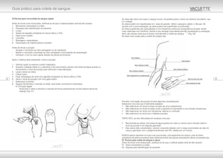 As veias são tubos nos quais o sangue circula, da periferia para o centro do sistema circulatório, que
é o coração.
As veias podem ser classificadas em: veias de grande, médio e pequeno calibre, e vênulas. De
1
acordo com a sua localização, as veias podem ser superficiais ou profundas.
As veias superficiais são subcutâneas e com freqüência visível por transparência da pele, sendo
mais calibrosas nos membros. Devido à sua situação subcutânea permitir visualização ou sensação
11, 13
táctil, são nessas veias que se fazem normalmente à coleta de sangue. (Fig. 03)
As veias mais usuais para a coleta de sangue são:
Escolher uma região de punção envolve algumas considerações:
Selecionar uma veia que é facilmente palpável;
• Não selecionar um local no braço ao lado de uma mastectomia;
• Não selecionar um local no braço onde o paciente foi submetido a uma infusão intravenosa;
• Não selecionar um local com hematoma, edema ou contusão;
• Não selecionar um local com múltiplas punções.
TENTE ISTO, se tiver dificuldade em localizar uma veia:
• Recomenda-se utilizar uma bolsa de água quente por mais ou menos cinco minutos sobre o
local da punção e em seguida garrotear;
• Nos casos mais complicados, colocar o paciente deitado com o braço acomodado ao lado do
corpo e garrotear com o esfigmomanômetro (em P.A. média) por um minuto.
NUNCA aplicar tapinhas no local a ser puncionado, principalmente em idosos, pois se forem
portadores de ateroma poderá haver deslocamentos das placas acarretando sérias conseqüências.
D) Técnica para coleta de sangue a vácuo
Antes de iniciar uma venipunção, certificar-se de que o material abaixo será de fácil acesso:
01. Tubos necessários à coleta;
02. Etiqueta para identificação do paciente;
A)Técnica para microcoleta de sangue capilar
Antes de iniciar uma microcoleta, certificar-se de que o material abaixo será de fácil acesso:
1. Microtubos necessários à coleta;
2. Etiquetas para identificação do paciente;
3. Luvas;
4. Swabs de algodão embebida em álcool etílico a 70%;
5. Gaze seca e estéril;
6. Lancetas;
7. Bandagem, esparadrapo;
8. Descartador de material pérfuro-cortante.
Antes de iniciar a punção:
- Acoplar o microtubo ao tubo carregador ou de transporte.
- Manter o microtubo conectado ao tubo carregador numa estante de sustentação.
- Introduzir o funil ou tubo capilar através da tampa de borracha.
Após o material estar preparado, iniciar a punção:
1. Verificar quais os exames a serem realizados;
2. Aquecer a falange distal ou o calcanhar a ser puncionado usando uma bolsa de água-quente ou
friccionando o local da punção para estimular a vascularização;
3. Lavar e secar as mãos;
4. Calçar luvas;
5. Fazer antissepsia do local com algodão embebido em álcool etílico a 70%;
6. Secar o local da punção com uma gaze estéril;
7. Selecionar a lanceta;
8. Segurar firmemente o neonato ou bebê, para evitar movimentos imprevistos.
8.1) Punção digital:
Posicionar o dedo e introduzir a lanceta de forma perpendicular na face lateral interna da
falange (Fig. 27).
0920
Guia prático para coleta de sangue.
Figura - 27
Figura - 03
Veia basílica
Veia Cefálica
Veia mediana cubital
Veia mediana cefálica
Veia longitudinal (ou antebraquial)
Veia mediana basílica
Veia do dorso da mão
Veia marginal da mão
 