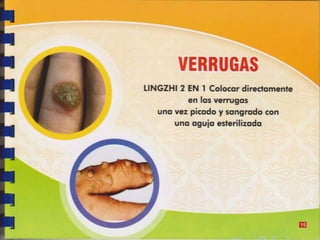 Guia de consumo ganoderma