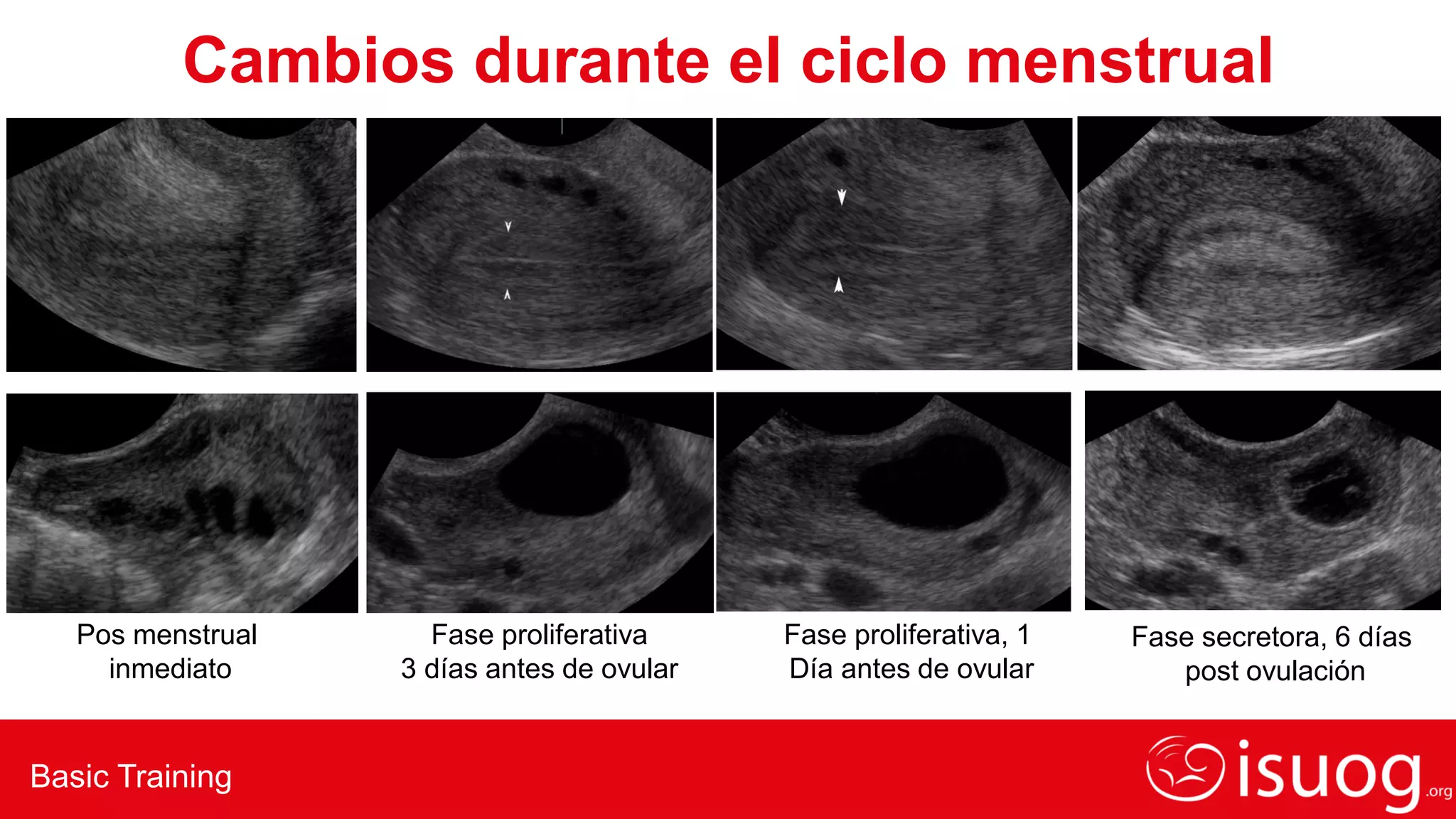 GUIA DE ECOGRAFIA DE utero-cuello-y-endometrio-rev-CV-1019.pdf
