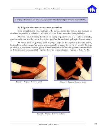 Guia para o Controle da Hanseníase




      A inspeção do interior dos calçados dos pacientes é fundamental para prevenir incapacidades.



          b) Palpação dos troncos nervosos periféricos
       Este procedimento visa verificar se há espessamento dos nervos que inervam os
membros superiores e inferiores, visando prevenir lesões neurais e incapacidades.
         O profissional de saúde deve ficar em frente ao paciente que está sendo examinado,
posicionando-a de acordo com a descrição específica da técnica de palpação de cada nervo.
          O nervo deve ser palpado com as polpas digitais do segundo e terceiro dedos,
deslizando-os sobre a superfície óssea, acompanhando o trajeto do nervo, no sentido de cima
para baixo. Não se deve esquecer que se os nervos estiverem inflamados poderão estar sensíveis
ou doloridos, merecendo cuidado e pouca força ao serem palpados (Figuras 4, 5, 6, 7 e 8).




       Figura 4 - Palpação do nervo radial                        Figura 5 - Palpação do nervo ulnar




                                   Figura 6 - Palpação do nervo mediano




                                    Cadernos da Atenção Básica                                         23
 