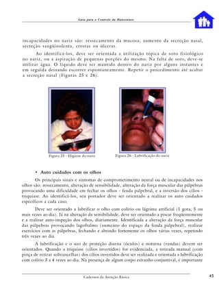 Guia para o Controle da Hanseníase




incapacidades no nariz são: ressecamento da mucosa, aumento da secreção nasal,
secreção sangüinolenta, crostas ou úlceras.
       Ao identificá-los, deve ser orientada a utilização tópica de soro fisiológico
no nariz, ou a aspiração de pequenas porções do mesmo. Na falta de soro, deve-se
utilizar água. O líquido deve ser mantido dentro do nariz por alguns instantes e
em seguida deixando escorrer espontaneamente. Repetir o procedimento até acabar
a secreção nasal (Figuras 25 e 26) .




              Figura 25 - Higiene do nariz           Figura 26 - Lubrificação do nariz



       • Auto cuidados com os olhos
       Os principais sinais e sintomas de comprometimento neural ou de incapacidades nos
olhos são: ressecamento, alteração de sensibilidade, alteração da força muscular das pálpebras
provocando uma dificuldade em fechar os olhos - fenda palpebral, e a inversão dos cílios -
triquíase. Ao identificá-los, seu portador deve ser orientado a realizar os auto cuidados
específicos a cada caso.
       Deve ser orientado a lubrificar o olho com colírio ou lágrima artificial (1 gota, 5 ou
mais vezes ao dia). Já na alteração da sensibilidade, deve ser orientado a piscar freqüentemente
e a realizar auto-inspeção dos olhos, diariamente. Identificada a alteração da força muscular
das pálpebras provocando lagoftalmo (aumento do espaço da fenda palpebral), realizar
exercícios com as pálpebras, fechando e abrindo fortemente os olhos várias vezes, repetindo
três vezes ao dia.
       A lubrificação e o uso de proteção diurna (óculos) e noturna (vendas) devem ser
orientados. Quando a triquíase (cílios invertidos) for evidenciada, a retirada manual (com
pinça de retirar sobrancelhas) dos cílios invertidos deve ser realizada e orientada a lubrificação
com colírio 3 a 4 vezes ao dia. Na presença de algum corpo estranho conjuntival, é importante


                                   Cadernos da Atenção Básica                                        45
 