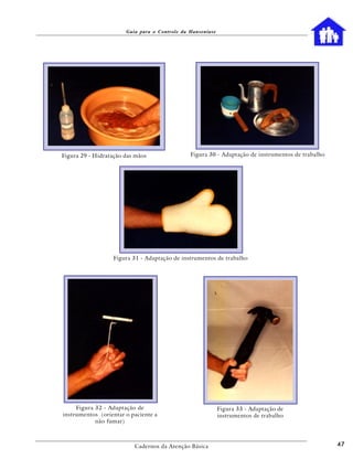 Guia para o Controle da Hanseníase




Figura 29 - Hidratação das mãos                Figura 30 - Adaptação de instrumentos de trabalho




                  Figura 31 - Adaptação de instrumentos de trabalho




     Figura 32 - Adaptação de                               Figura 33 - Adaptação de
instrumentos (orientar o paciente a                         instrumentos de trabalho
            não fumar)



                          Cadernos da Atenção Básica                                               47
 
