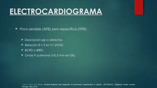 ELECTROCARDIOGRAMA
 Poco sensible (50%) pero específica (70%):
 Desviación eje a derecha.
 Relación R > S en V1 (HVD)
 BCRD o BIRD.
 Onda P pulmonar (>2,5 mm en DII).
Lewis J Rubin, MD et al. «Clinical features and diagnosis of pulmonary hypertension in adults”. UPTODATE. Literature review current
through: May 2015.
 