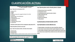 CLASIFICACIÓN ACTUAL
 