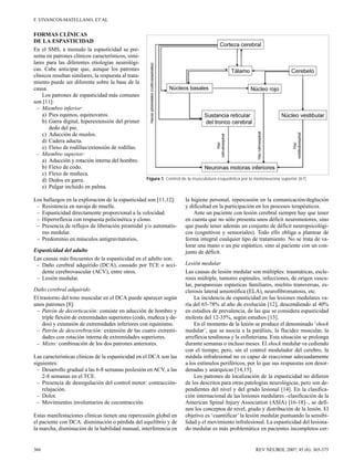 F. VIVANCOS-MATELLANO, ET AL

FORMAS CLÍNICAS
DE LA ESPASTICIDAD
En el SMS, a menudo la espasticidad se pre­
senta en patrones clínicos característicos, simi­
lares para las diferentes etiologías neurológi­
cas. Cabe anticipar que, aunque los patrones
clínicos resultan similares, la respuesta al trata­
miento puede ser diferente sobre la base de la
causa.
Los patrones de espasticidad más comunes
son [11]:
–	 Miembro inferior:

a) Pies equinos, equinovaros. 

b) Garra digital, hiperextensión del primer

dedo del pie.
c) Aducción de muslos.
d) Cadera aducta.
e) Flexo de rodillas/extensión de rodillas.
–	 Miembro superior:

a) Aducción y rotación interna del hombro. 

b) Flexo de codo.

c) Flexo de muñeca. 

d) Dedos en garra. 

e) Pulgar incluido en palma. 


Núcleos basales

Figura 1. Control de la musculatura esquelética por la motoneurona superior [67].

Los hallazgos en la exploración de la espasticidad son [11,12]:
– Resistencia en navaja de muelle.
– Espasticidad directamente proporcional a la velocidad.
– Hiperreflexia con respuesta policinética y clono.
–	 Presencia de reflejos de liberación piramidal y/o automatis­
mo medular.
– Predominio en músculos antigravitatorios,
Espasticidad del adulto
Las causas más frecuentes de la espasticidad en el adulto son:
–	 Daño cerebral adquirido (DCA), causado por TCE o acci­
dente cerebrovascular (ACV), entre otros.
– Lesión medular.
Daño cerebral adquirido
El trastorno del tono muscular en el DCA puede aparecer según
unos patrones [8]:
–	 Patrón de decorticación: consiste en aducción de hombro y
triple flexión de extremidades superiores (codo, muñeca y de­
dos) y extensión de extremidades inferiores con equinismo.
–	 Patrón de descerebración: extensión de las cuatro extremi­
dades con rotación interna de extremidades superiores.
– Mixto: combinación de los dos patrones anteriores.
Las características clínicas de la espasticidad en el DCA son las
siguientes:
–	 Desarrollo gradual a las 6-8 semanas poslesión en ACV, a las
2-8 semanas en el TCE.
–	 Presencia de desregulación del control motor: contracciónrelajación.
– Dolor.
– Movimientos involuntarios de cocontracción.
Estas manifestaciones clínicas tienen una repercusión global en
el paciente con DCA: disminución o pérdida del equilibrio y de
la marcha, disminución de la habilidad manual, interferencia en

366

la higiene personal, repercusión en la comunicación/deglución
y dificultad en la participación en los procesos terapéuticos.
Ante un paciente con lesión cerebral siempre hay que tener
en cuenta que no sólo presenta unos déficit neuromotores, sino
que puede tener además un conjunto de déficit neuropsicológi­
cos (cognitivos y sensoriales). Todo ello obliga a plantear de
forma integral cualquier tipo de tratamiento. No se trata de va­
lorar una mano o un pie espástico, sino al paciente con un con­
junto de déficit.
Lesión medular
Las causas de lesión medular son múltiples: traumáticas, escle­
rosis múltiple, tumores espinales, infecciones, de origen vascu­
lar, paraparesias espásticas familiares, mielitis transversas, es­
clerosis lateral amiotrófica (ELA), neurofibromatosis, etc.
La incidencia de espasticidad en las lesiones medulares va­
ría del 65-78% al año de evolución [12], descendiendo al 40%
en estudios de prevalencia, de las que se considera espasticidad
molesta del 12-35%, según estudios [13].
En el momento de la lesión se produce el denominado ‘shock
medular’, que se asocia a la parálisis, la flacidez muscular, la
arreflexia tendinosa y la esfinteriana. Esta situación se prolonga
durante semanas o incluso meses. El shock medular va cediendo
con el tiempo; pero, sin el control modulador del cerebro, la
médula infralesional no es capaz de reaccionar adecuadamente
a los estímulos periféricos, por lo que sus respuestas son desor­
denadas y anárquicas [14,15].
Los patrones de localización de la espasticidad no difieren
de los descritos para otras patologías neurológicas, pero son de­
pendientes del nivel y del grado lesional [14]. En la clasifica­
ción internacional de las lesiones medulares –clasificación de la
American Spinal Injury Association (ASIA) [16-18]–, se defi­
nen los conceptos de nivel, grado y distribución de la lesión. El
objetivo es ‘cuantificar’ la lesión medular puntuando la sensibi­
lidad y el movimiento infralesional. La espasticidad del lesiona­
do medular es más problemática en pacientes incompletos cer-

REV NEUROL 2007; 45 (6): 365-375

 