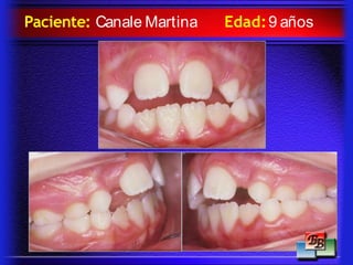 Paciente: Canale Martina Edad:9 años
 