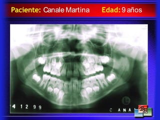 Paciente: Canale Martina Edad:9 años
 