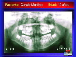 Paciente: Canale Martina Edad:10 años
 