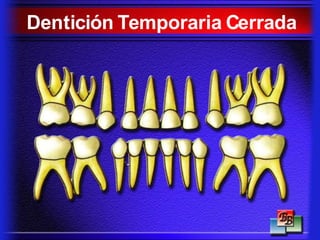 Dentición Temporaria Cerrada
 