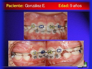 Paciente: González E. Edad:9 años
 