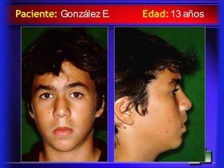 Paciente: González E. Edad:13 años
 