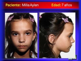 Paciente: MillaAylen Edad:7 años
 