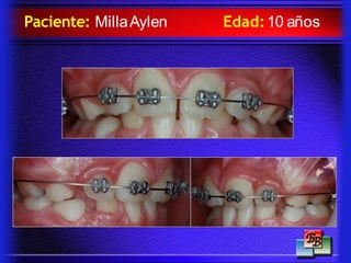 Paciente: MillaAylen Edad:10 años
 