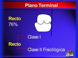 Plano Terminal
Recto
76%
Clase I
Recto
Clase II Fisiológica
 