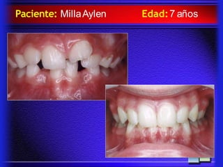 Paciente: MillaAylen Edad:7 años
 