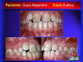 Paciente: Cupo Alejandro Edad:8 años
 