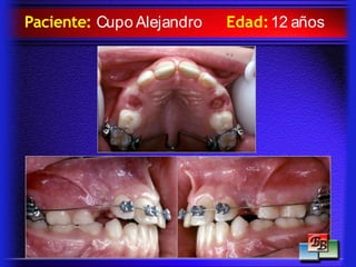 Paciente: Cupo Alejandro Edad:12 años
 