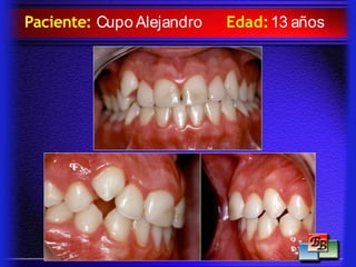 Paciente: Cupo Alejandro Edad:13 años
 