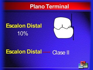 Escalon Distal
10%
Escalon Distal Clase II
Plano Terminal
 