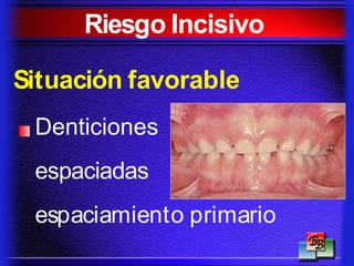 Riesgo Incisivo
Situación favorable
Denticiones
espaciadas
espaciamiento primario
 