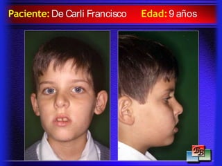 Paciente:De Carli Francisco Edad:9 años
 