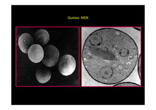 Quistes.
Quistes MEB

 