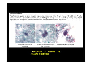 Trofozoítos y quistes
Giardia intestinalis

de

 