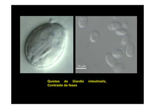 Quistes de Giardia
Contraste de fases

intestinalis,

 