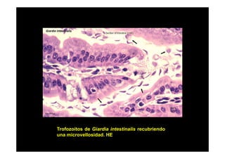 Trofozoítos de Giardia intestinalis recubriendo
una microvellosidad. HE
i
ll id d

 