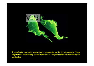 T. vaginalis, parásito protozoario causante de la tricomoniasis (fase
g
)
p
vegetativa: trofozoíto). Descubierto en 1839 por Donné en secreciones
vaginales

 