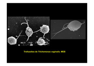 Trofozoítos de Trichomonas vaginalis. MEB

 