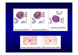 Gametocyte (DPDx)
Gametocyte (DPDx)

Gametocyte (DPDx)

Female gametocyte (CMU) Male gametocyte (CMU)

 