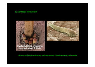 5) Demodex folliculorum

Ácaros en folículos pilosos y piel descamada. Se alimenta de piel muerta

 