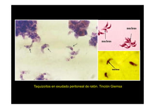 Taquizoítos en exudado peritoneal de ratón. Tinción Giemsa

 