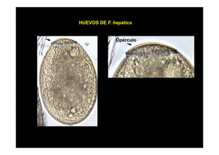 HUEVOS DE F. hepática
p

Opérculo
p

 