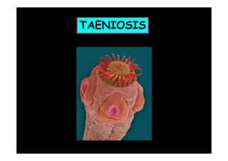 TAENIOSIS

 